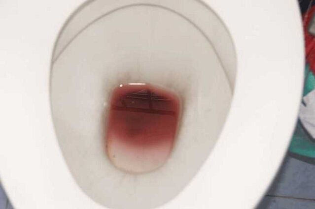 đốm ở nam giới khi bị kích thích